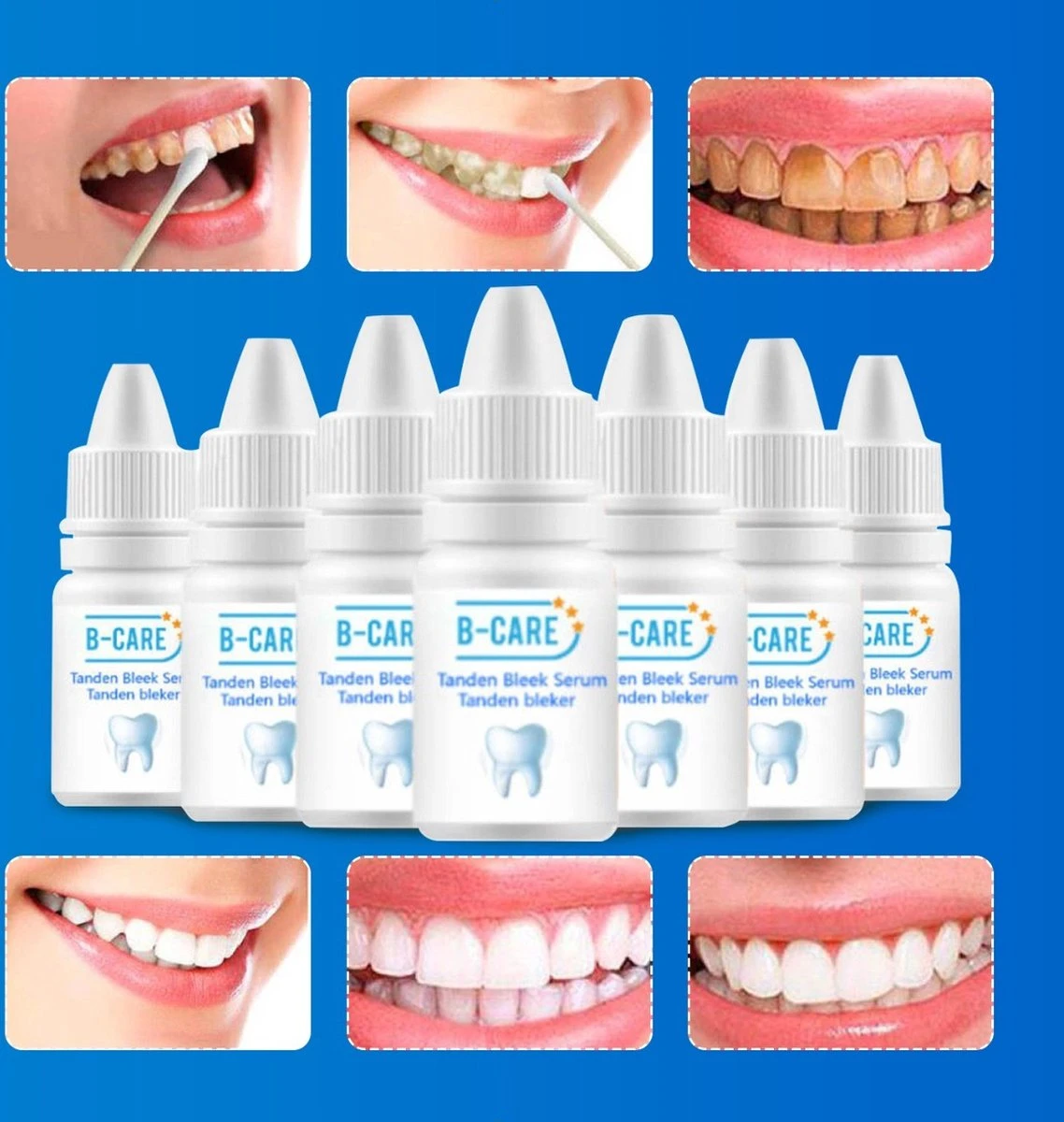 B-care Tanden Bleker – Wittere Tanden – Teeth Whitening Strips – Professioneel Resultaat - Tandsteen Verwijderaar - Zonder Peroxide - Tandenbleekset - Tanden Bleken - Afbeelding 9