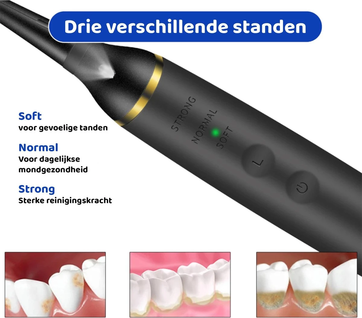 ExCorn Elektrische Tandsteen Verwijderaar - Inclusief 6-delig Tandartsset - 3 Standen - Elektrisch Tandplak Verwijderen - Tanden Polijsten - Afbeelding 6