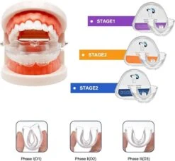 SAMA Direct™ Rechte Tanden Zonder Beugel - Orthodontische Bitjes - Rechte Tanden Bitje - Beugel - Knarsbitje - Nachtbeugel - Knarsen Bitje - Rechte Tanden - Witte Tanden