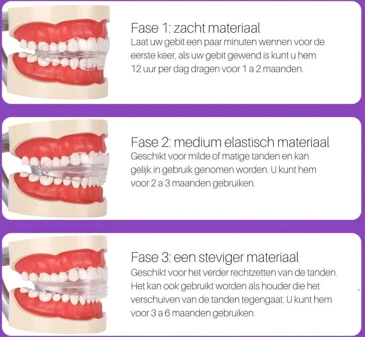 Edoir Rechte Tanden Beugel - Retainer Voor Rechte Tanden - Rechte Tanden Bitje - Afbeelding 3