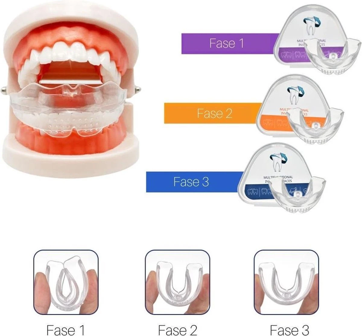 Edoir Rechte Tanden Beugel - Retainer Voor Rechte Tanden - Rechte Tanden Bitje - Afbeelding 2
