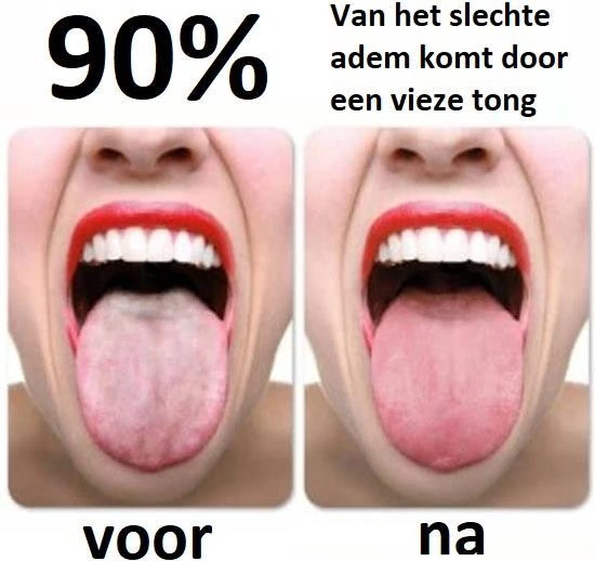 Effectieve Tongschraper (hoge Kwaliteit) - Tongreiniger Koper - Mondverzorging - Persoonlijke Verzorging – Rose Gold - Underdog Tech - Afbeelding 2