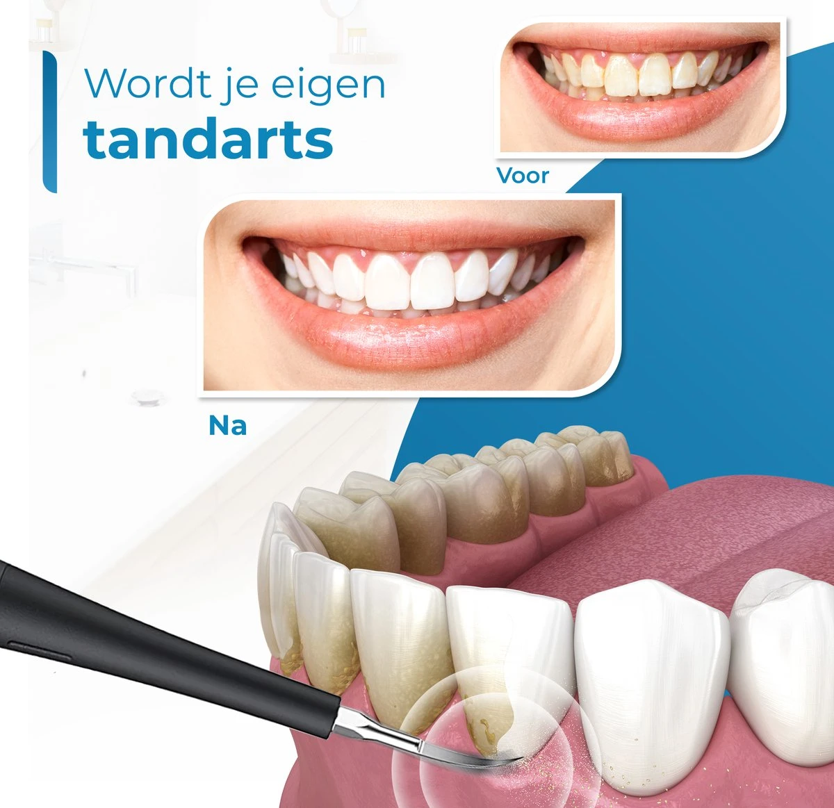 Professionele Tandsteen Verwijderaar - 5 Standen - Inclusief Tandarts Set - Met 3 Opzetstukken - Elektrisch - Tandplak - Afbeelding 2