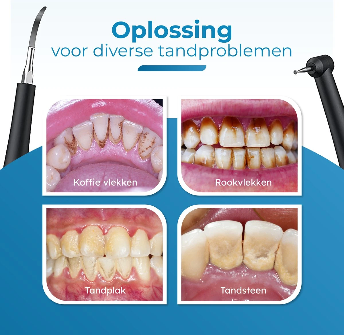 Professionele Tandsteen Verwijderaar - 5 Standen - Inclusief Tandarts Set - Met 3 Opzetstukken - Elektrisch - Tandplak - Afbeelding 3
