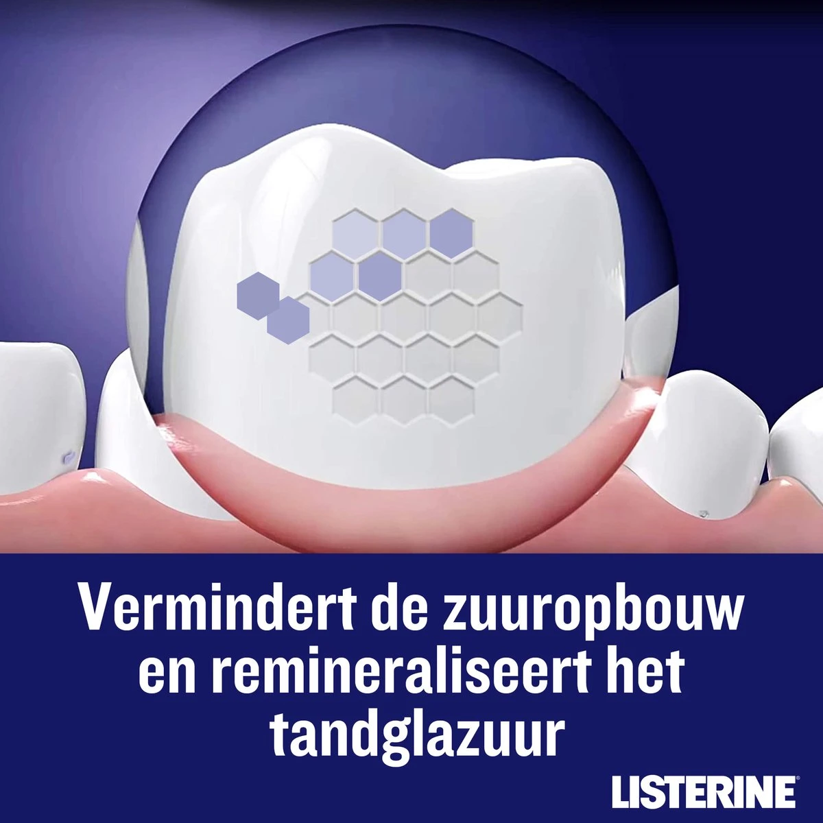 LISTERINE Nightly Reset Milde Smaak, Mondspoeling Met RAPID-FUSHION -technologie Voor Gebruik Tijdens De Nacht, Hermineraliseert Het Tandglazuur, 3 X 400 Ml - Afbeelding 6