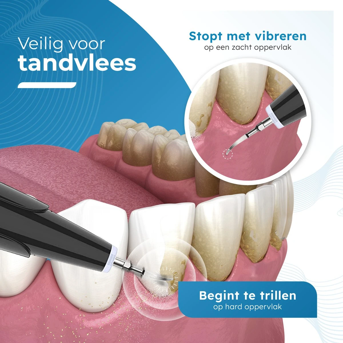 V-Goods Premium Sonische Tandsteen Verwijderaar - 5 Standen - Inclusief Tandarts Set - 3 Opzetstukken - Tandplak - Afbeelding 5