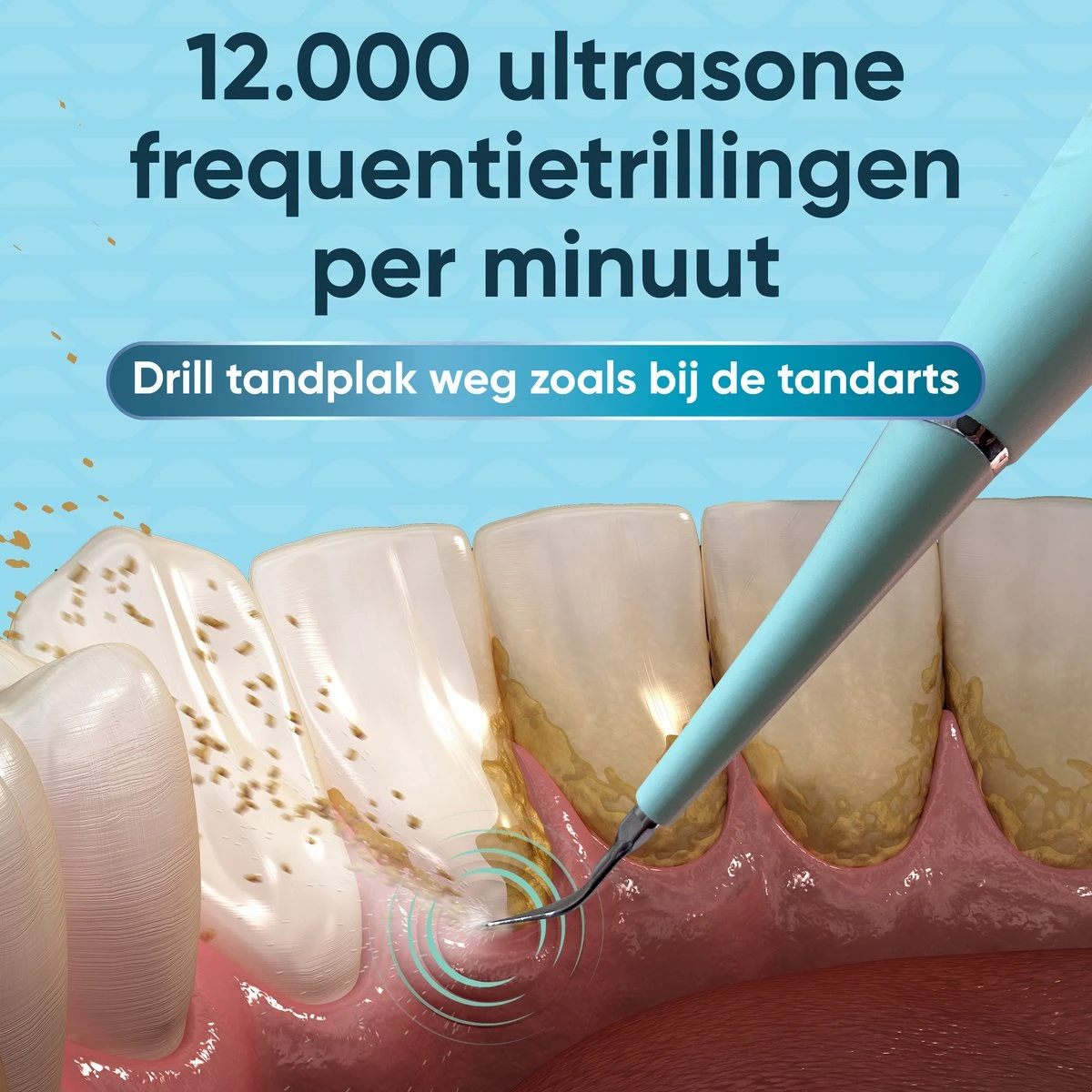 Whitee Elektrische Tandsteen Verwijderaar - Tanden Polijsten - Tandarts Tandsteenverwijderaars - Elektrisch Tandplak Verwijderen - Afbeelding 5