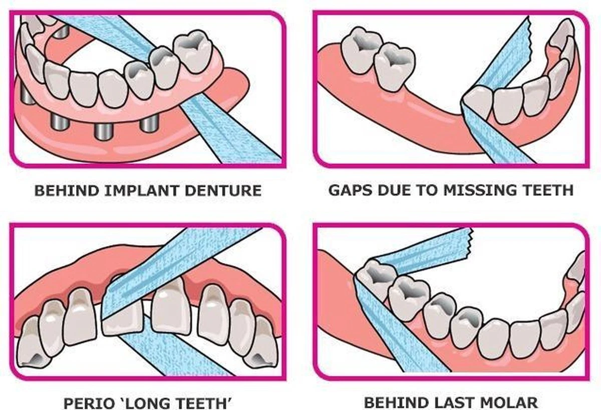 IDontix X-Ribbon - 12mtr - Afbeelding 2